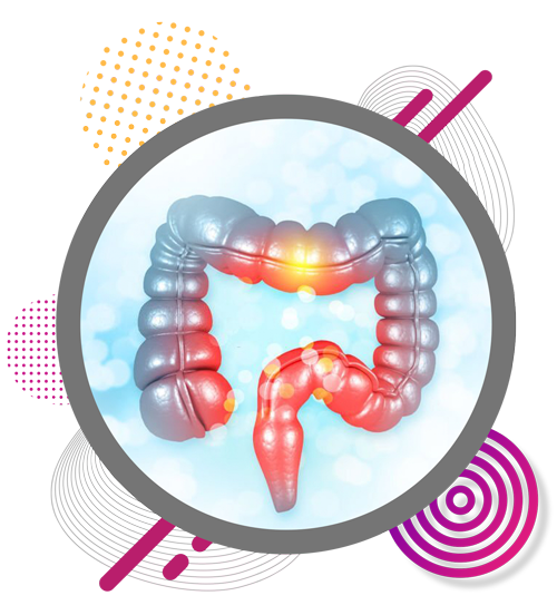 constipation-treatment-in-chennai