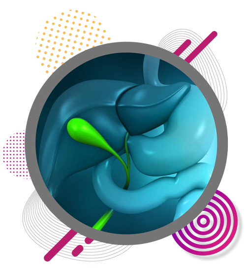 gallbladder-stones-in-chennai