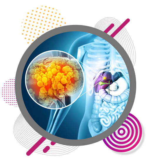 liver-cyst-cancer-tumour-in-chennai