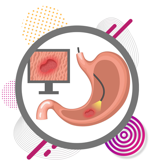 endoscopy-in-chennai