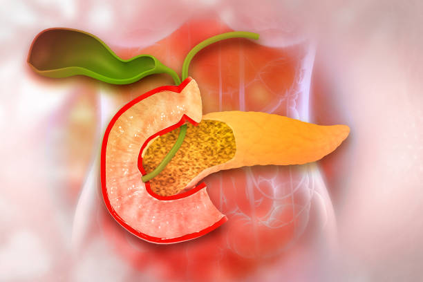 Acute Pancreatitis